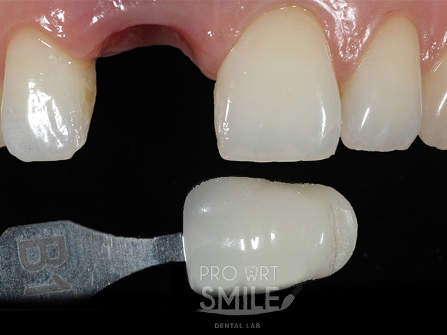 Dental lab