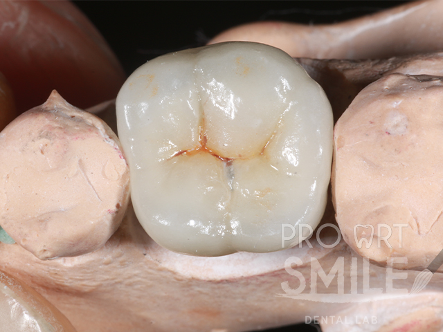Dental lab