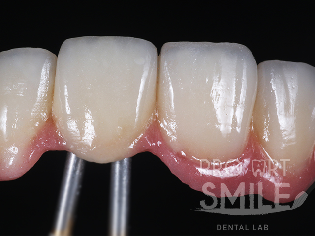 Dental lab