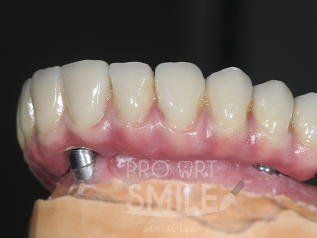 Dental lab