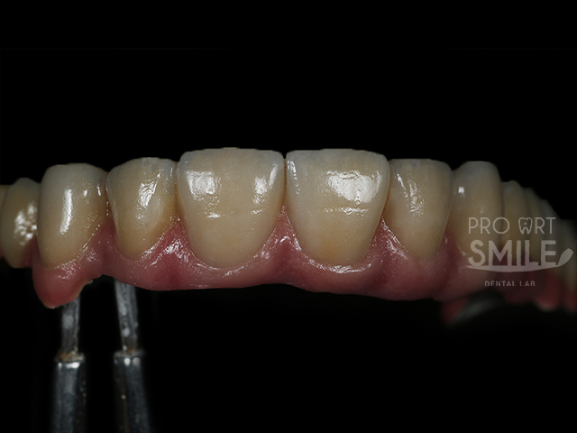 Dental lab